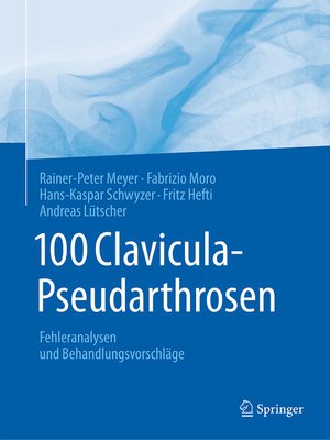 cover image of 100 Clavicula-Pseudarthrosen